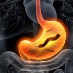 胃がん発症者の99%がピロリ菌に感染。その感染ルートと対策は？