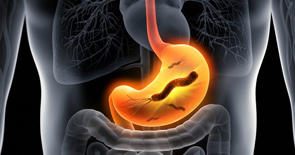 ピロリ菌は胃の中にだけ生息する