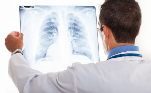 stocking121100009.jpg - doctor examining a lung radiography