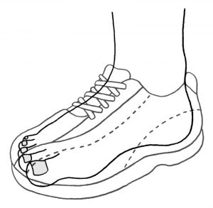 靴底のすり減り方で体の歪みがわかる！改善法と正しい靴の選び方とは