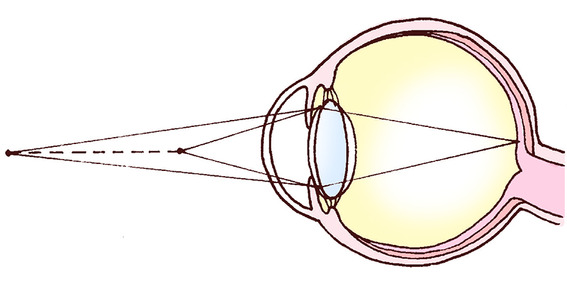 水晶体、網膜、毛様体筋など目の構造を表すイラスト