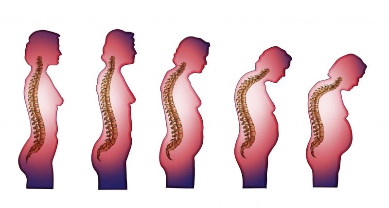 女性の腰が曲がっていく骨の様子を過程を年代別に表すイラスト