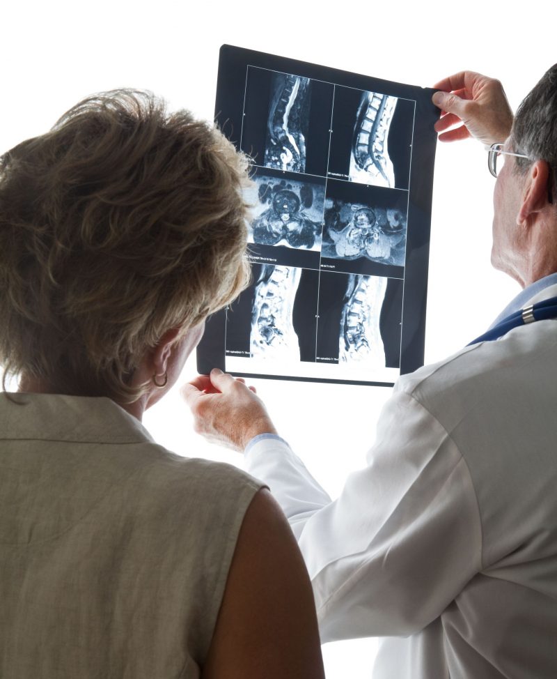 骨のレントゲン画像をみる医者と女性患者