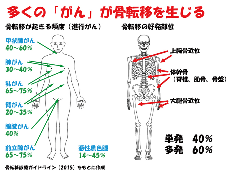 骨転移の頻度を示した図