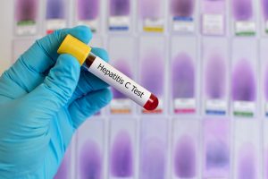 C型肝炎治療後の肝がん発症予防に「血中亜鉛濃度測定」