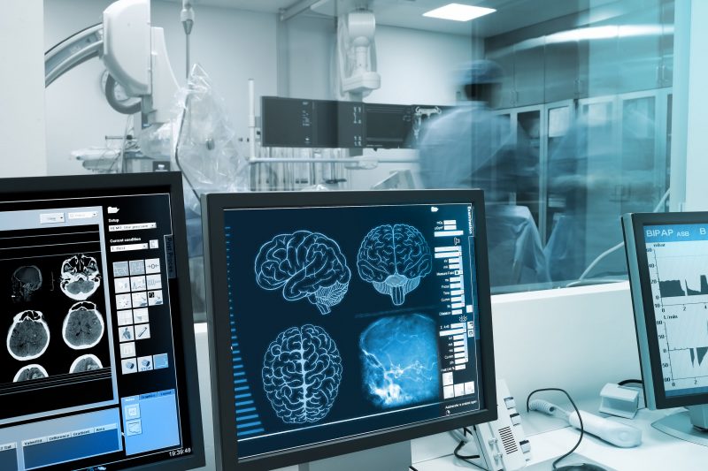 脳のレントゲン画像と検査室