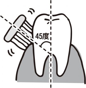 大人の虫歯ケア｜歯茎が下がる！「根面う蝕」を予防する歯の最新ケア方法。50代以上は要注意