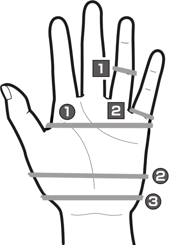 便秘の場合は手のひらの親指の谷間、根元、手首の上あたりを横断するように輪ゴムを巻き付けている。下痢の場合、薬指の第二関節と小指の根元に輪ゴムを巻き付けている図