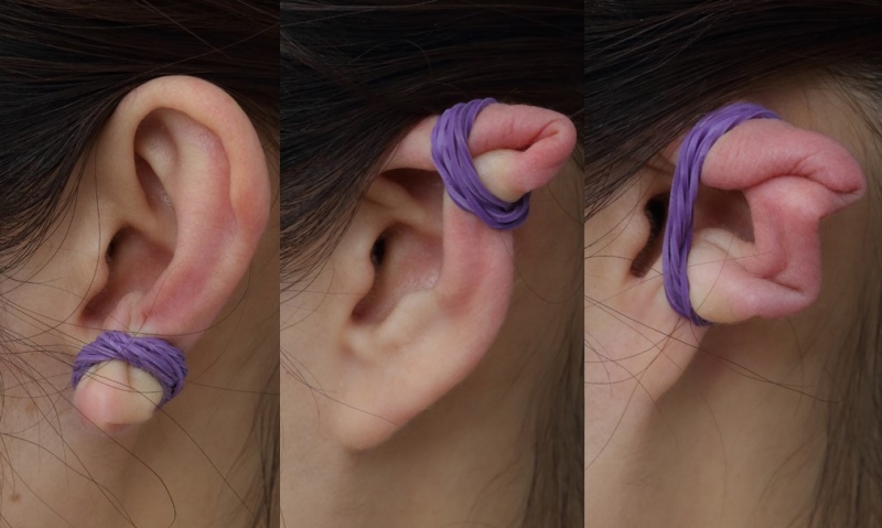耳に輪ゴムをかけている健康法の例３つ