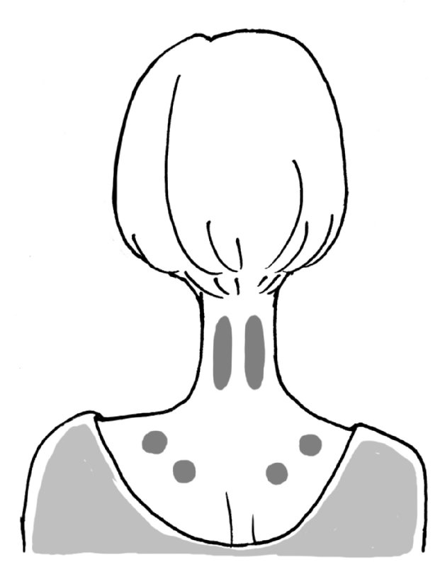 女性の上半身後ろ姿、首の後ろの筋肉と肩のツボを記したイラスト