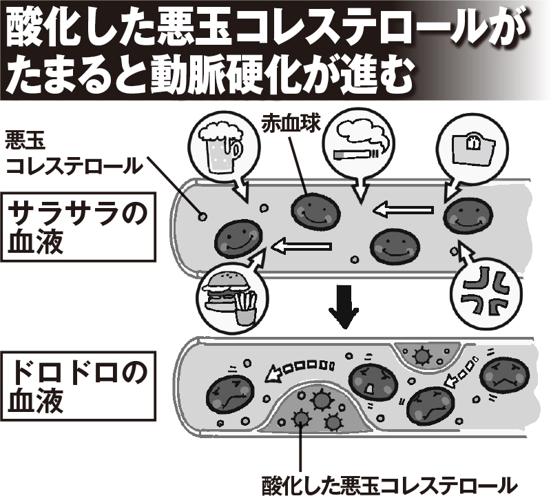 病気や死を招く「ドロドロ血液」あなたの危険度は？ 改善する食材と食べ方を紹介 (1/1)| 介護ポストセブン