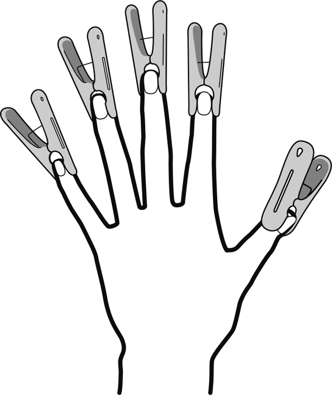 5本の指の爪の側面にそれぞれ洗濯ばさみではさんだ手のイラスト