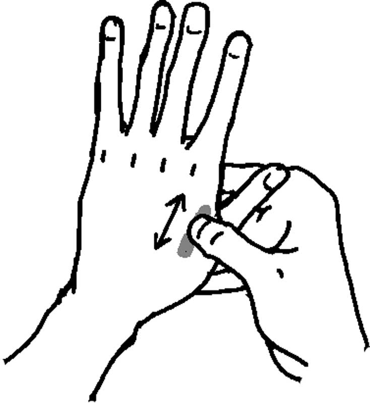 母指CM関節症　親指の付け根の「CM関節」の軟骨がすり減り痛みが発症
