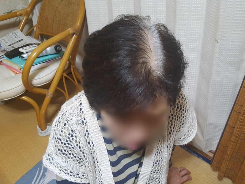 工藤広伸さんのお母さんの白髪の生え際が見える写真