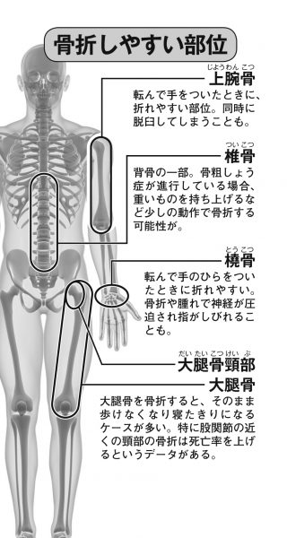 Definition Of 骨張る: 骨張った手 | 手を変え品を変えの類語・関連語・連想語: 連想類語辞典 – VHPD
