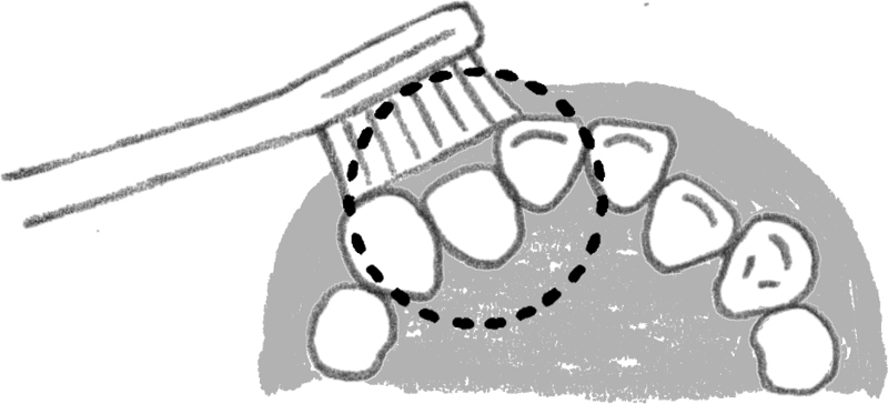 凹凸の歯並びの磨き方のイラスト