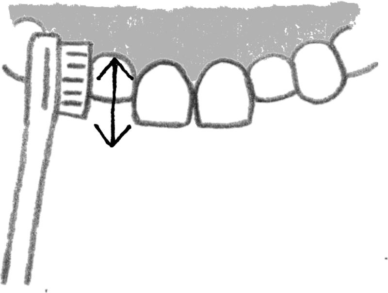 凹凸の歯並びの磨き方