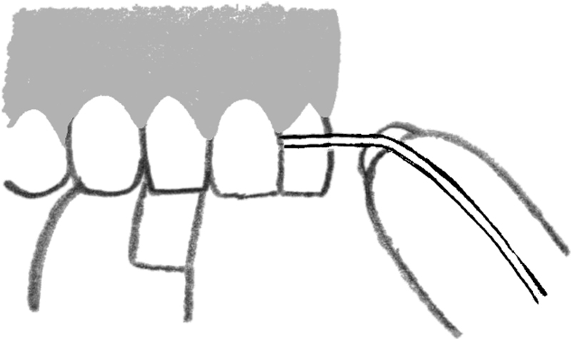 歯と歯の間の隙間が広くなってきたら歯間ブラシを使う。
