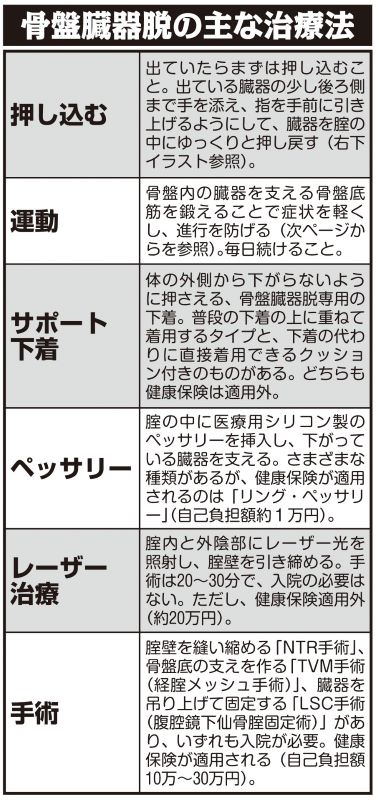 骨盤臓器脱の主な治療法