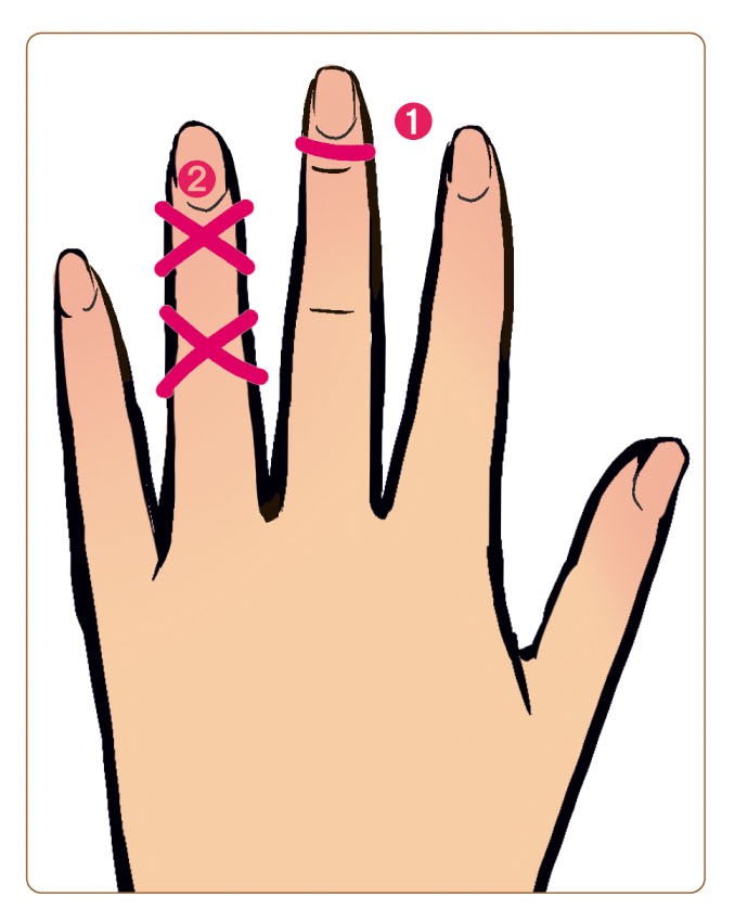 輪ゴムを中指の指先、薬指にバツを2つつくり巻き付けた手の甲のイラスト