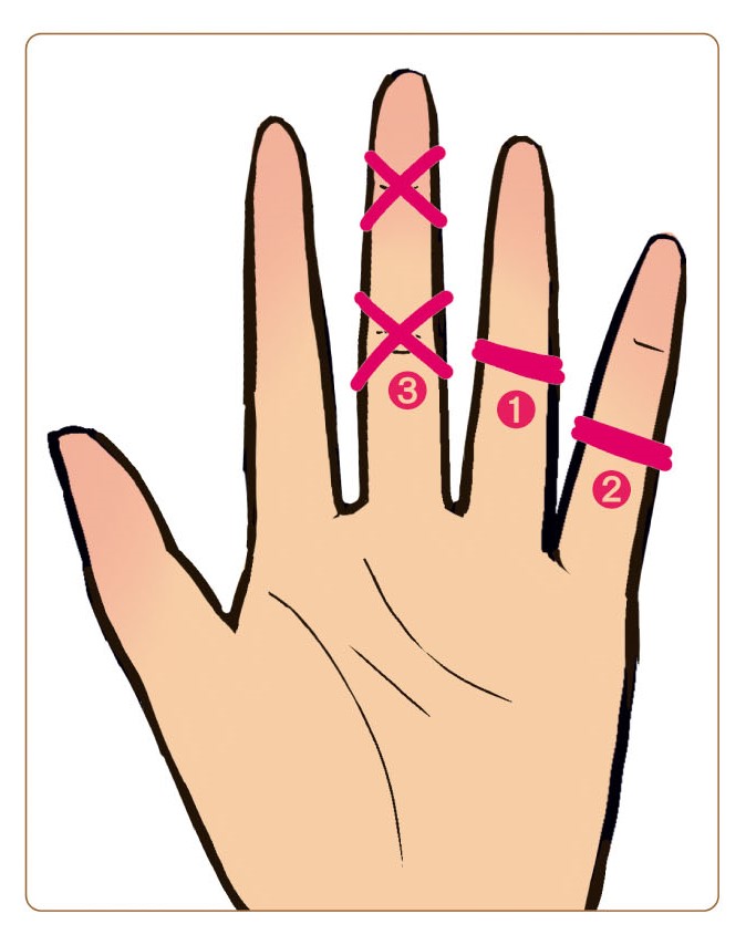 輪ゴムを中指にバツ2つ作り、薬指と小指の中央に二重に巻き付けた手のイラスト