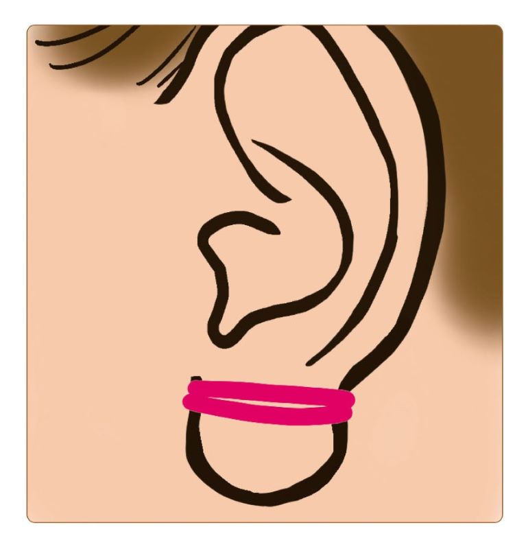輪ゴムを二重に巻き付けた女性の耳のイラスト