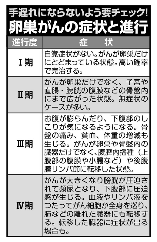 卵巣がんの症状と進行