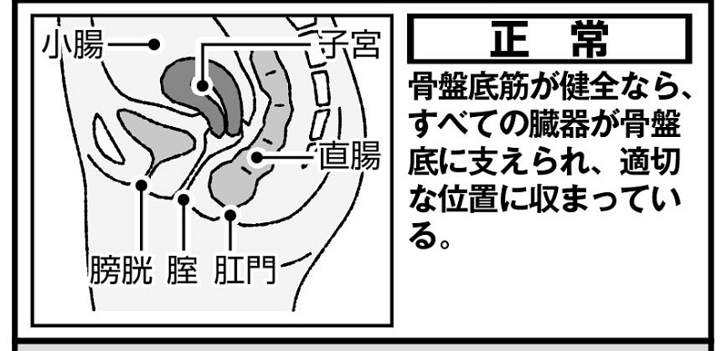 正常な状態