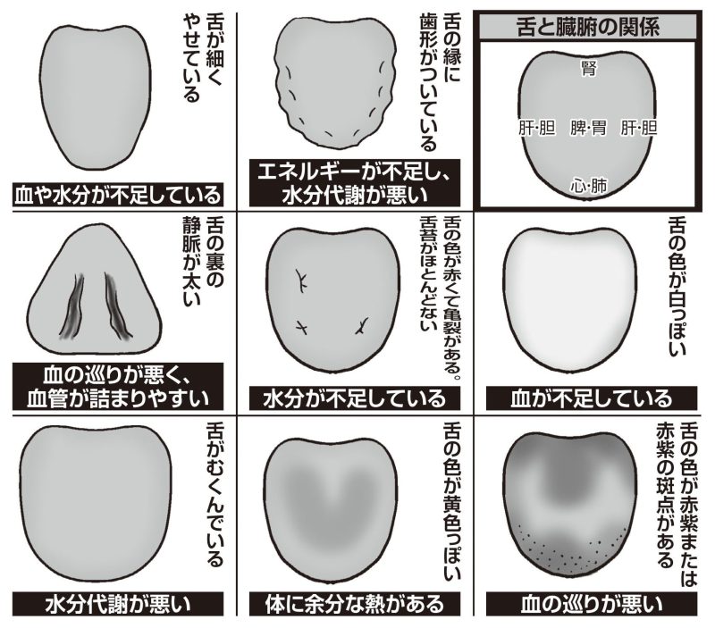 “舌診（ぜつしん）”のポイント