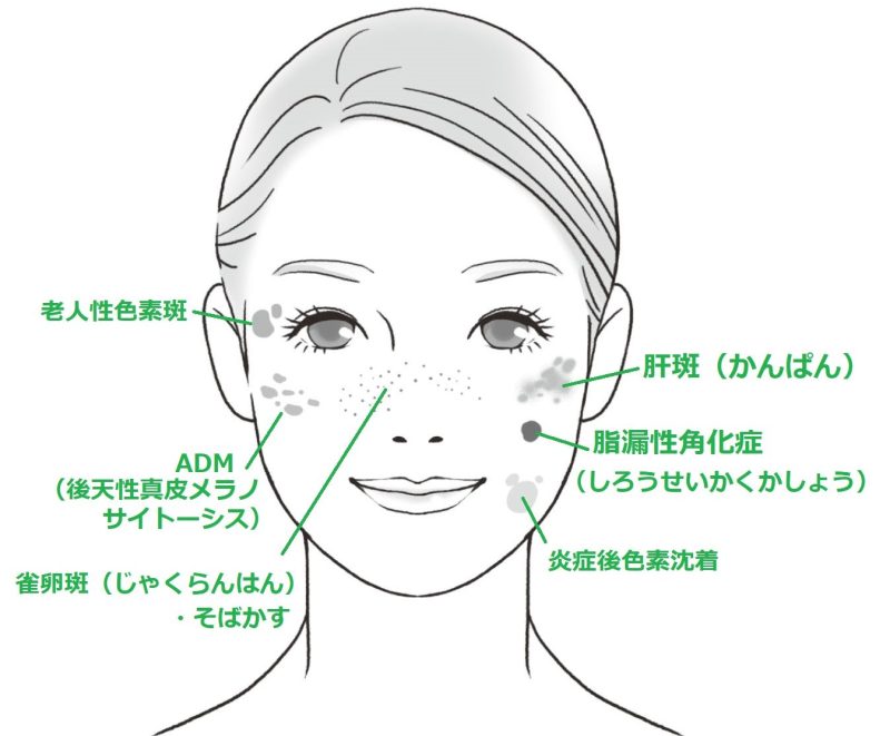 シミの位置と名前