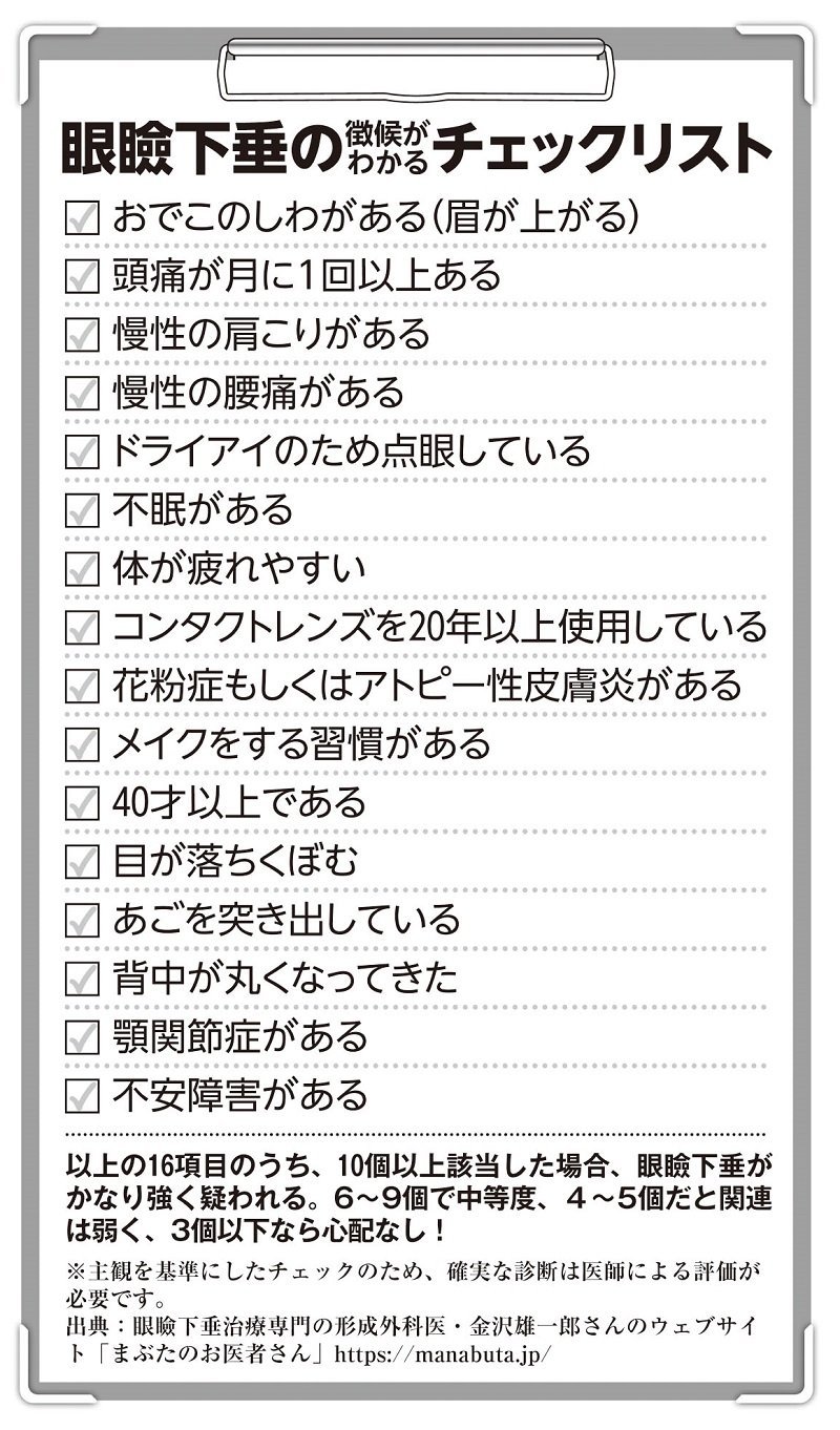 眼瞼下垂の徴候がわかるチェックリスト