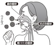 意外と知られていない抗菌薬（抗生物質）で風邪は治らないという事実　改めて学びたい「細菌」と「ウイルス」の違い