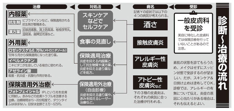 酒さの診断〜治療の流れ