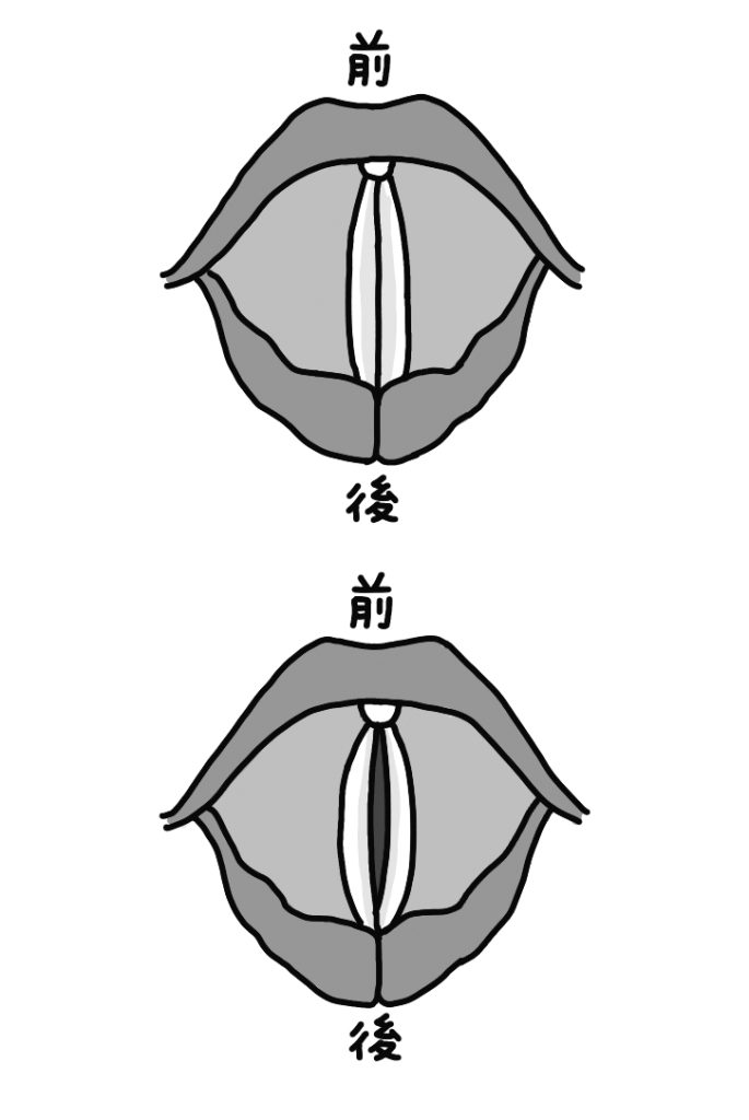 声が出しづらいと思ったら要チェック！“声枯れ”に潜む危険な病気8「あー、と10秒続けて言えなかったら何らかの異変」【医師解説】 (1/1