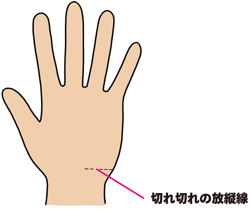 切れ切れの放縦線