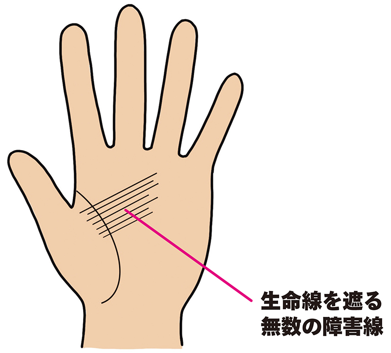 生命線を遮る無数の障害線