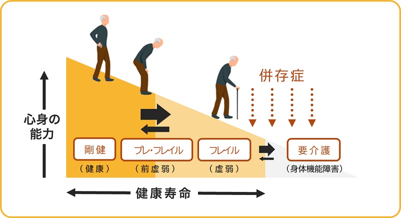 フレイルを放っておくと要介護状態へ進んでしまうことも